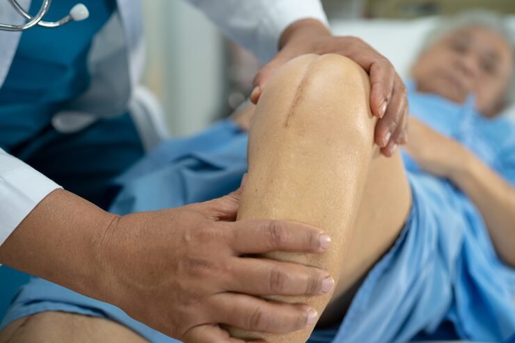 Knee Replacement Clinic in New Delhi