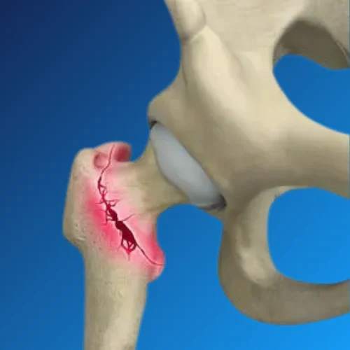 Arthroscopy Image 2