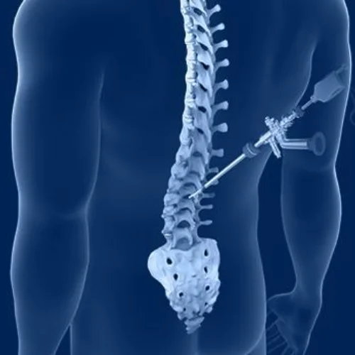 Spine Surgery Image 1