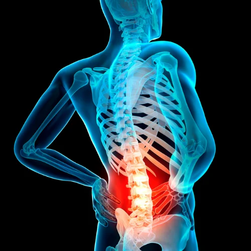 Spine Surgery Image 3